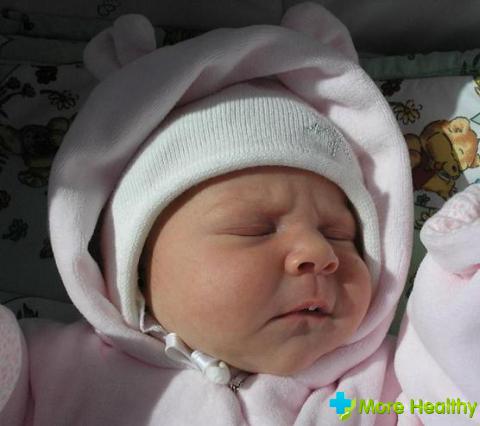 Мозоли на губах у грудного ребенка Мозоли на губах у грудного ребенка