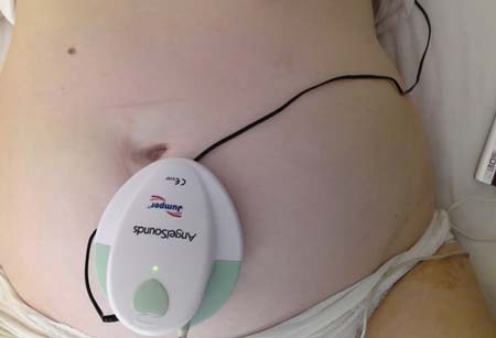 Доплер хороший. Фетальный допплер для беременных w8-25. Доплер сердцебиение плода. BT-200 фетальный допплер. Допплер аппарат для беременных.