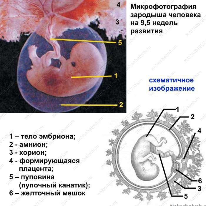 Организм эмбрион. Зародышевые оболочки амнион и хорион. Хорион амнион желточный мешок. Строение зародыша хорион амнион. Аллантоис амнион хорион плацента.