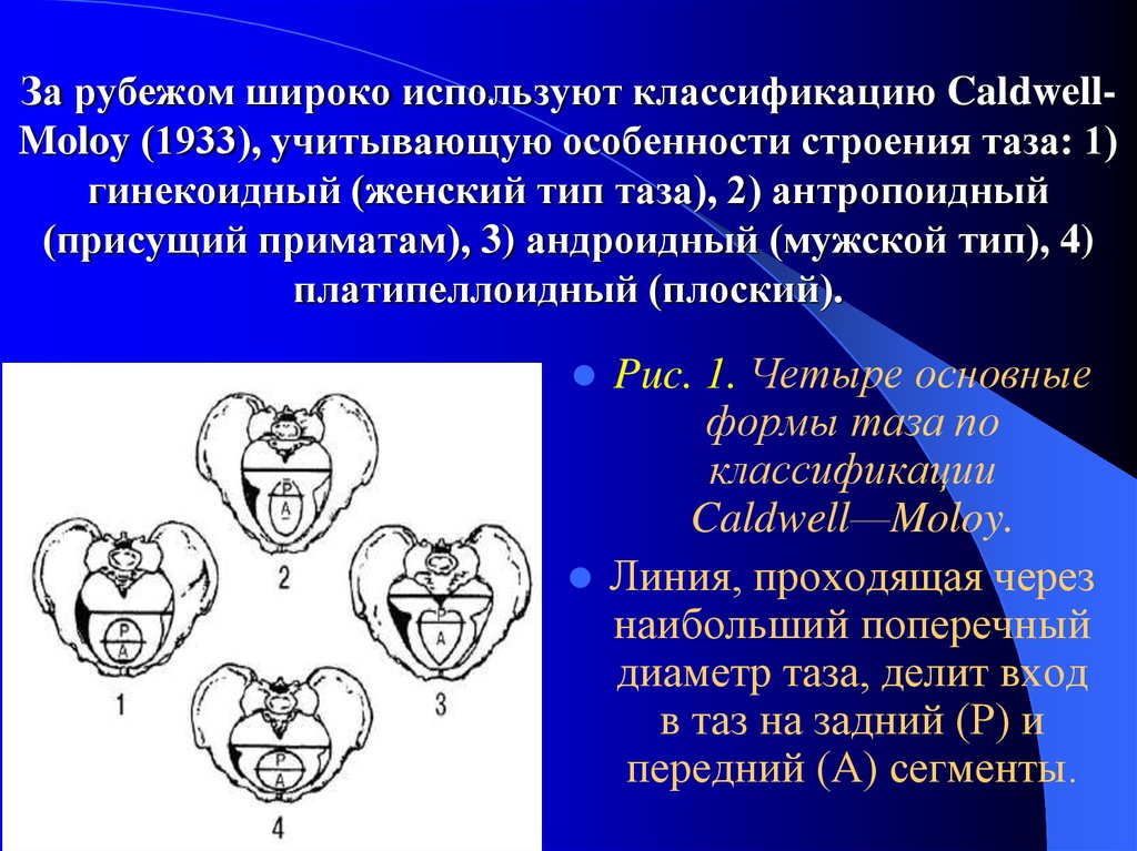 Гинекоидный таз. Классификация узкого таза Акушерство. Гинекоидный Тип таза. Узкий таз анатомия.