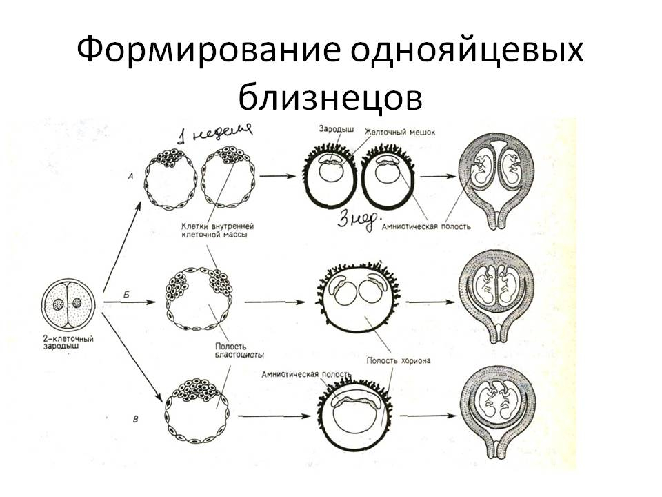 Как появляются близнецы