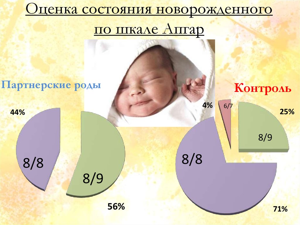 Оценка новорожденного. Оценка состояния новорожденного. Оценка состояния новорожденного по шкале Апгар. Оценить состояние новорожденного. Оценка состояния здоровья новорожденного ребенка.