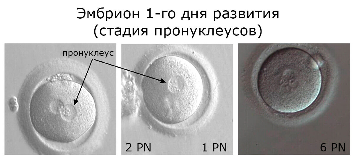 Подготовка к криопереносу. Стадия пронуклеусов. Эмбрион при эко. Эмбрионы по стадиям развития эко.