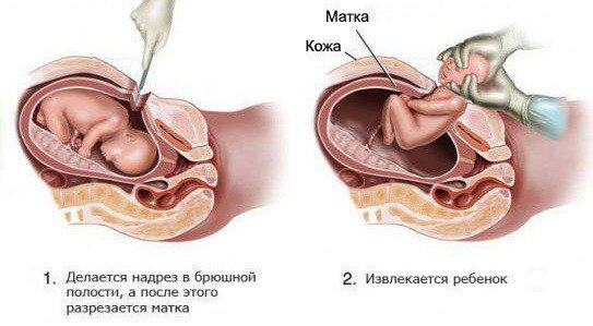 Влагалище После Родов Картинки