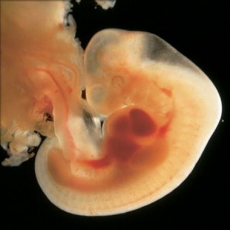 Эмбрион человека 7 неделя