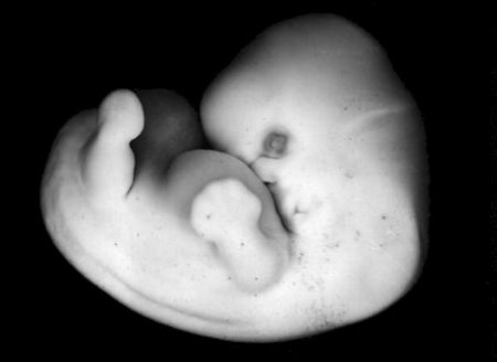 Развитие эмбриона человека на 6 неделе фото