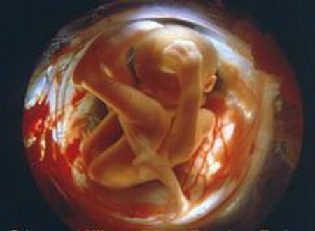 Зародыш человека 19 неделя