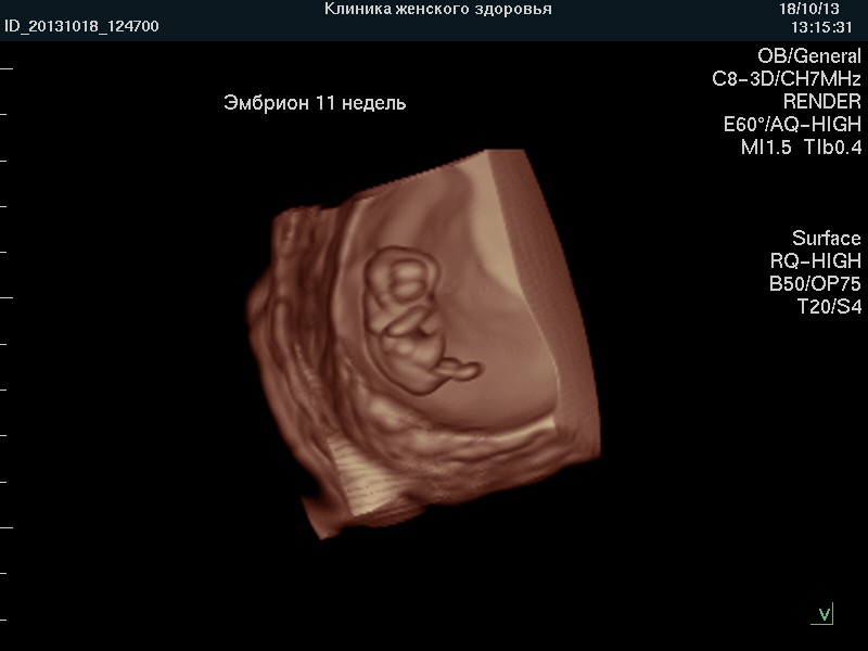 Плода нижний новгород. 3д УЗИ на 20 неделе беременности. Плод 20 недель беременности 4д УЗИ.
