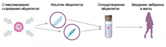 Заморозка Яйцеклеток Стоимость По Москве