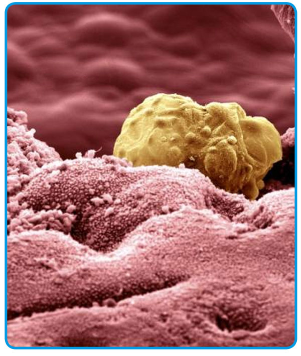 Имплантация зародыша в эндометрий. Имплантация эмбриона в эко. Оплодотворение яйцеклетки и имплантация в матке. Имплантация эмбриона в эко. Матка и прикрепившийся плод.