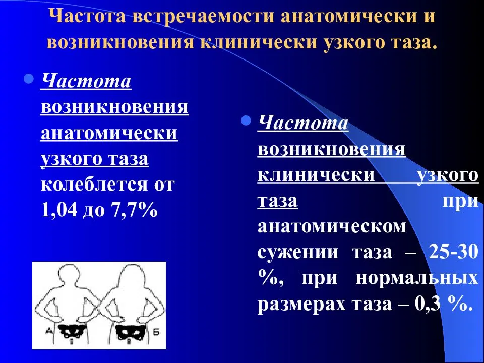 Клинический узкий таз презентация