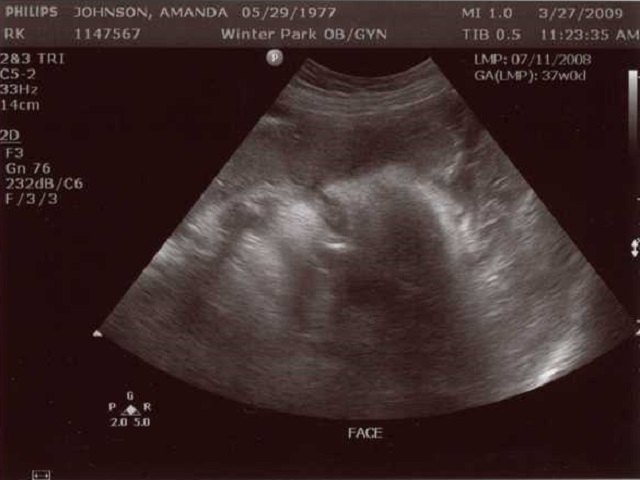 37 недель мальчик. УЗИ 37 недель беременности. УЗИ живота беременность. После УЗИ болит низ живота.