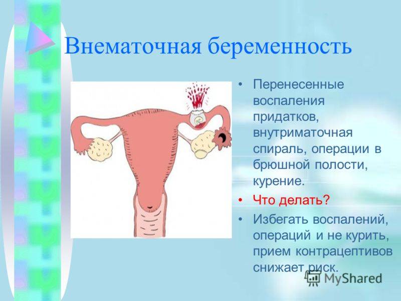 Возможность Беременности При Анальном Сексе