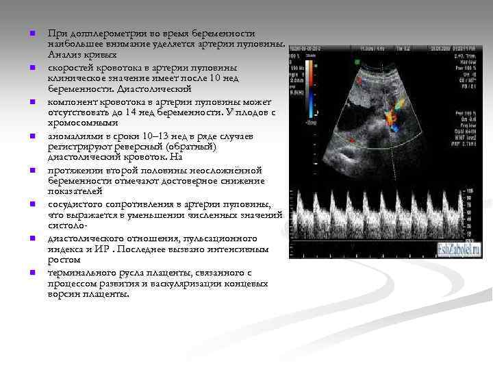 Гемодинамика при беременности. Нормы допплерометрии среднемозговой артерии плода. Допплерометрическое исследование кровотока плода при беременности. Средняя мозговая артерия УЗИ норма. Средняя мозговая артерия допплер норма.