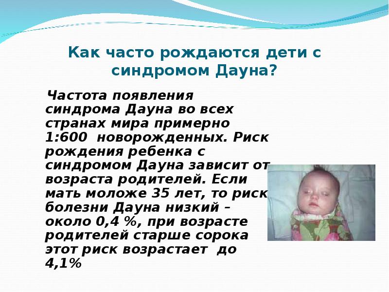 Сколько детей рождается в семье. Рождение ребенка с синдромом д. Причины рождения ребенка Дауна.