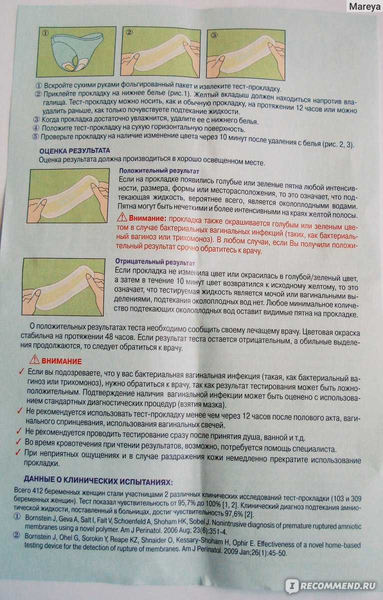 Что значит подтекать. Подтекание околоплодных вод. Содтекание оуолоплодных АОД. Подтекание вод при беременности.