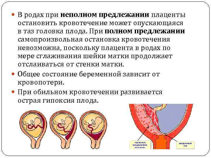 Можно Ли Секс При Низкой Плацентации