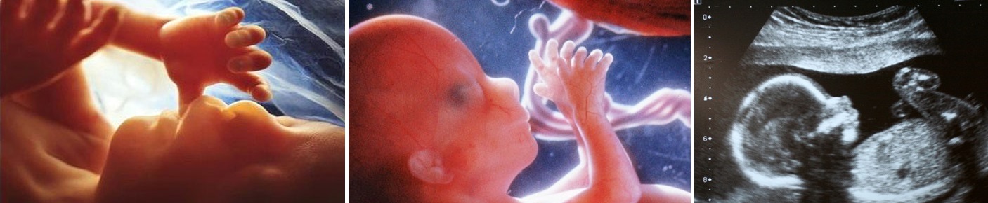 Внутриутробная жизнь ребенка. Малыш в утробе в 1 месяц беременности фото. Младенец 2 месяца в утробе матери. Ребенок в 2 месяца в утро.е.